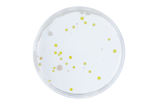 Petri dish or culture media with bacteria on white background with clipping, Test various germs, virus, Coronavirus, Corona, COVID-19, Microbial population count.