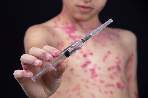 Un niño sostiene una jeringa con una vacuna contra el virus en la mano. photo
