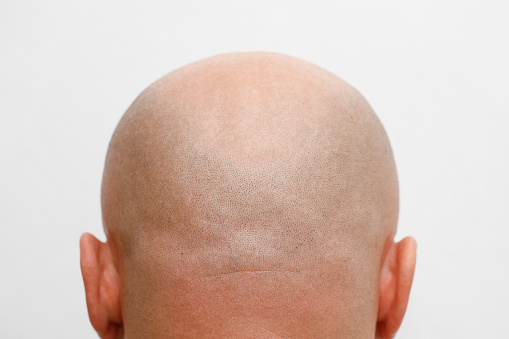 Shaved head rear view. Skinhead. Bald man