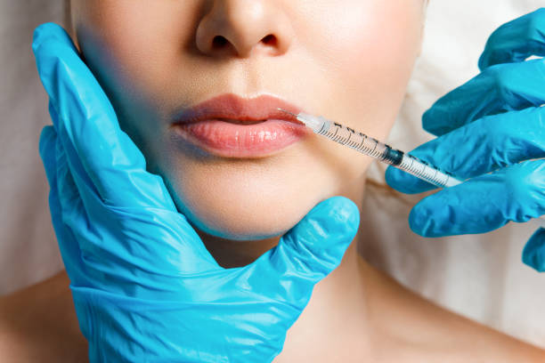 A woman makes lip shape correction in a cosmetology clinic. Lips injections, lip augmentation A woman makes lip shape correction in a cosmetology clinic. Lips injections, lip augmentation fillers stock pictures, royalty-free photos & images