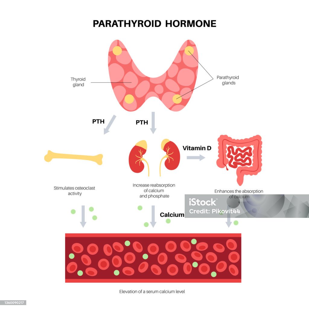 Anatomi Kelenjar Paratiroid Ilustrasi Stok Unduh Gambar Sekarang secondary-hyperparathyroidism-pathophysiology-and-treatment-american