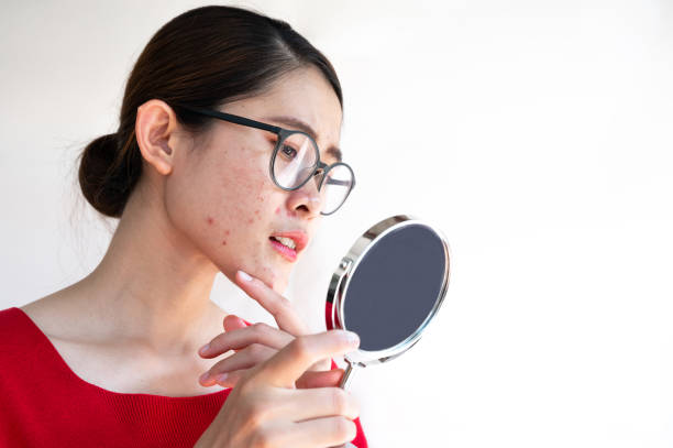 Portrait of worried Asian woman with bad emotional while looking acne and scar occur on her face by mini mirror. Conceptual shot of Acne and Problem Skin on female face. woman acne stock pictures, royalty-free photos & images