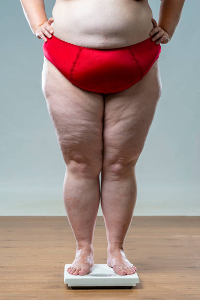 istock Post christmas dieting. Determined to shed the pounds 1360350419