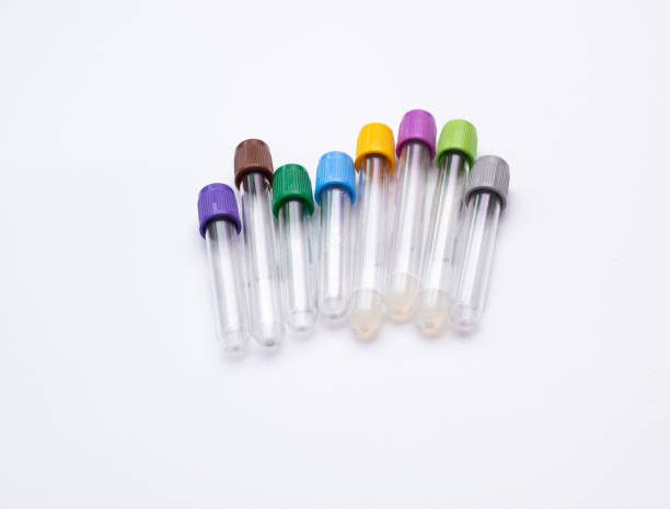 istock Vacuum tubes for collection blood samples on white background for laboratory 1360376657