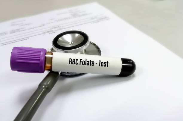 blood sample tube for rbc folate test. to measures the amount of folate in the blood.  folic acid. red blood cell folate concentration is considered the most reliable indicator of folate status. - blood red blood cell blood cell blood sample imagens e fotografias de stock