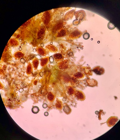 Detail under the microscope of sporangia (leptosporangia) of ferns.