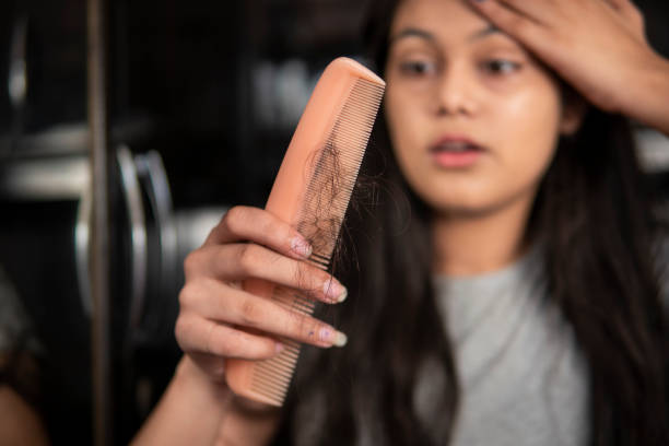 istock Indian woman getting worried about her hair loss problems. 1360521790