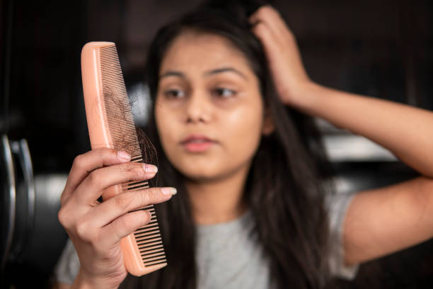 indian woman getting worried about her hair loss problems. - indian falls imagens e fotografias de stock