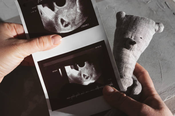 Early Pregnancy Ultrasound Results in female hands stock photo