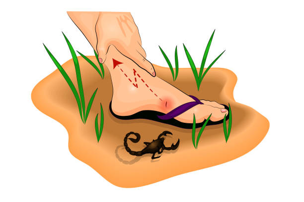 Scorpion sting illustration of a Scorpion sting on the foot venom symbol stock illustrations