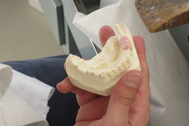istock dental laboratory dental prostheses 1360566069