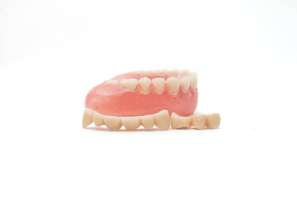 istock dental laboratory dental prostheses 1360566160