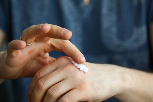 istock Male hard hands with calluses apply moisturizer 1360577618