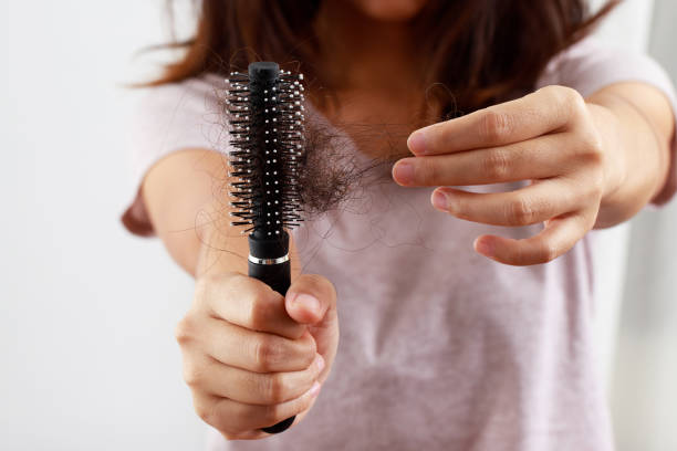 istock young woman worried about Hair loss problem after comb in hand. problem hormonal disbalance, stress concept. Health care concept 1360678103