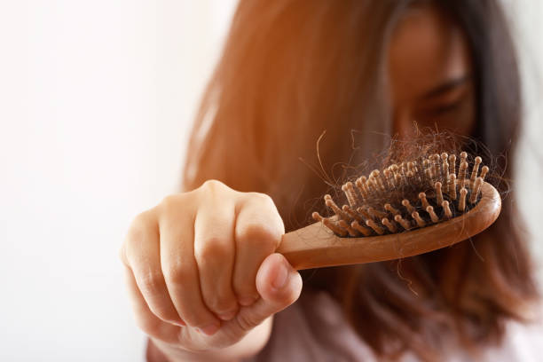 istock young woman worried about Hair loss problem after comb in hand. problem hormonal disbalance, stress concept. Health care concept 1360678268