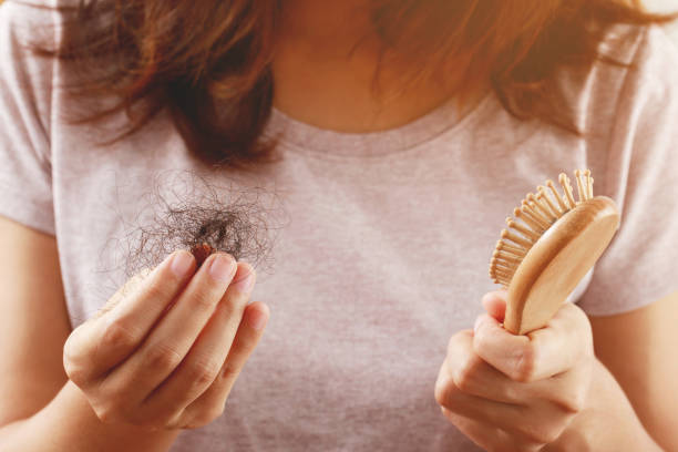 istock young woman worried about Hair loss problem after comb in hand. problem hormonal disbalance, stress concept. Health care concept 1360678270