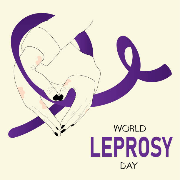 World Leprosy Day poster. Vector cartoon illustration of  hands with a heart shape holding a red ribbon. leprosy stock illustrations