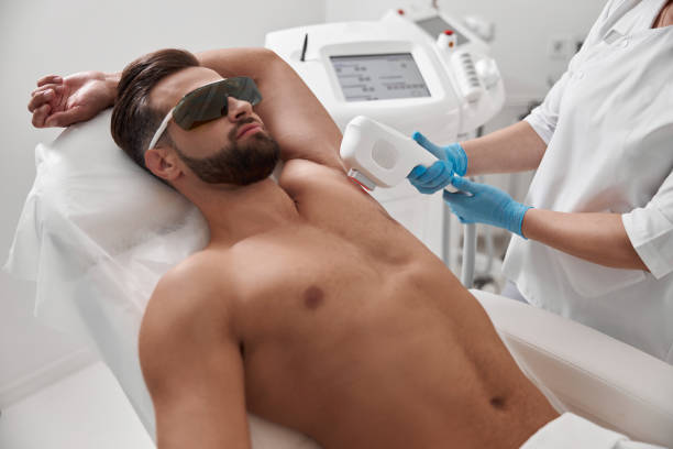 Man with goggles and bare chest undergoes procedure of arm pit laser epilation in clinic stock photo