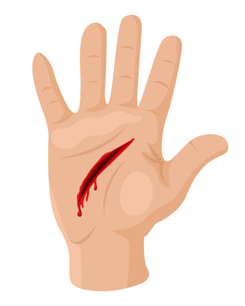 Injured Hand Stock Illustration - Download Image Now - Blood, First Aid,  Art - iStock