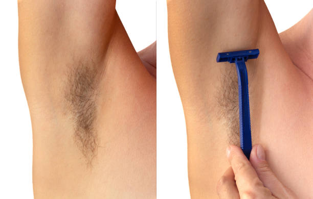 istock Collage isolated woman hairy unshaved armpit and hairy unshaved armpit with razor on white background holding arm straight 1360774622