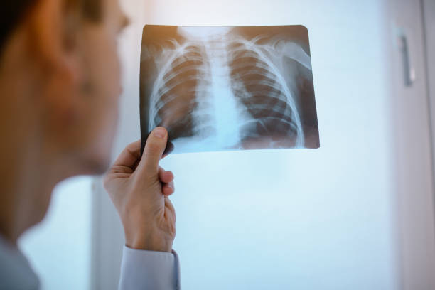 picture of young man doctor who analysis chest x ray Close up picture of young man doctor who analysis chest x ray respiratory disease stock pictures, royalty-free photos & images