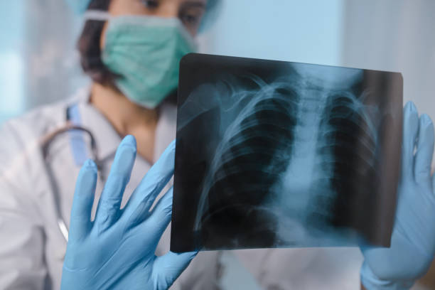 istock female doctor analyse  chest x-ray 1360814260