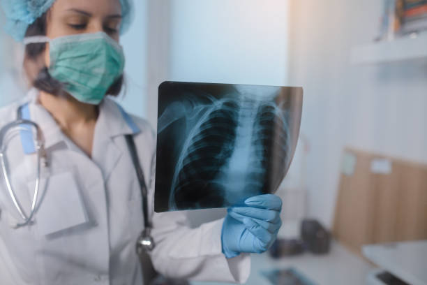 istock female doctor analyse  chest x-ray 1360814378