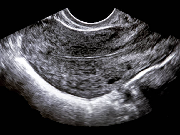 konsep pemeriksaan kesehatan wanita. - serviks foto potret stok, foto, & gambar bebas royalti