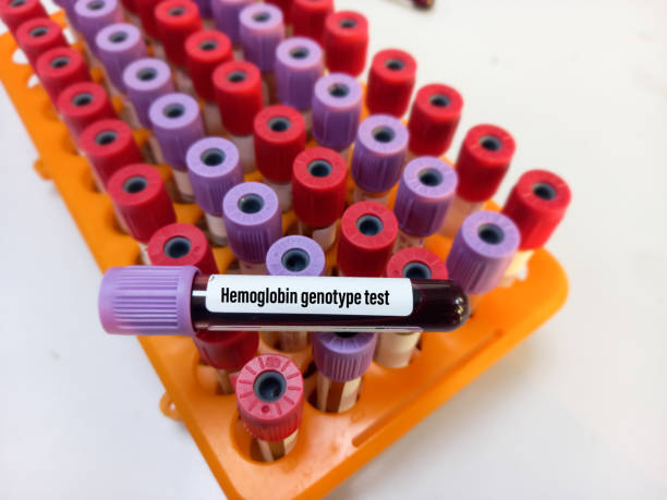Blood sample tube with blood for Hemoglobin genotype test, hemoglobin evaluation, sickle cell screen. Blood sample tube with blood for Hemoglobin genotype test, hemoglobin evaluation, sickle cell screen. blood typing stock pictures, royalty-free photos & images