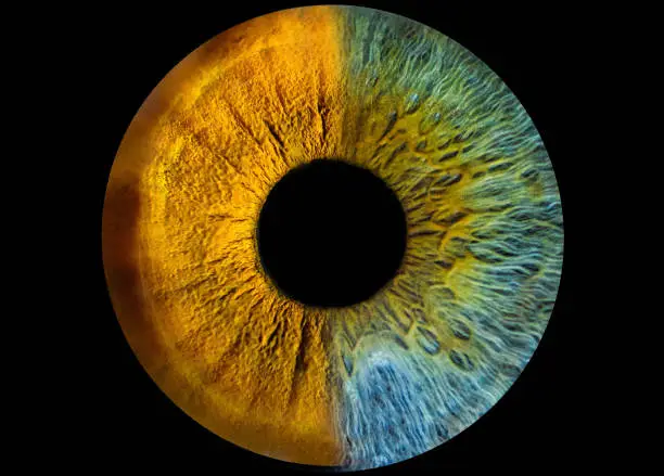 eye close-up. iris heterochromia, two-color iris with dark background