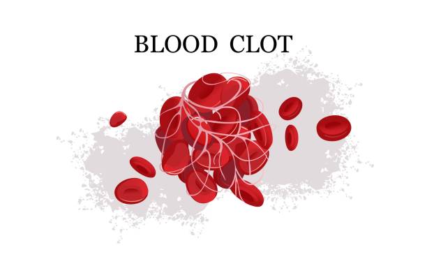 plakat medyczny skrzepliny skrzepliny krwi - human cardiovascular system blood human blood vessel platelet stock illustrations