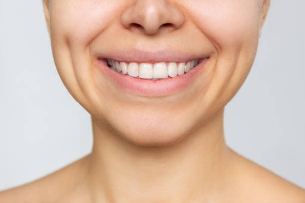 foto recortada de una joven caucásica con dientes blancos perfectos aislados sobre un fondo blanco - dimple fotografías e imágenes de stock