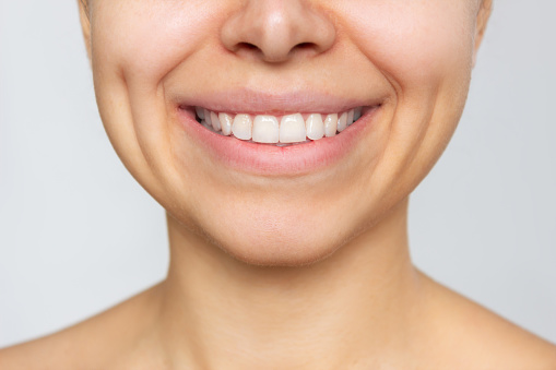 Cropped shot of a young caucasian woman with perfect white even teeth isolated on a white background. Oral hygiene, dental health care. Close-up of beautiful smile, dimples on the cheeks. Dentistry