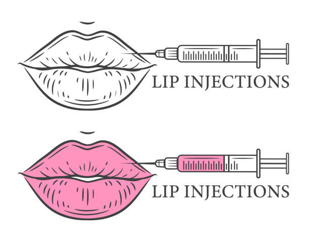 Lip beauty injection augmentation by hyaluronic acid filler outline icon. Medical syringe for cosmetology procedure. Correction form female mouth. Face skin rejuvenation. Aesthetic plastic surgery. Line vector Lip beauty injection augmentation by hyaluronic acid filler outline icon. Syringe for face cosmetology procedure in medical clinic. Correction form female mouth. Facial rejuvenation treatment, skin lifting. Aesthetic plastic surgery. Line vector silicone implants stock illustrations