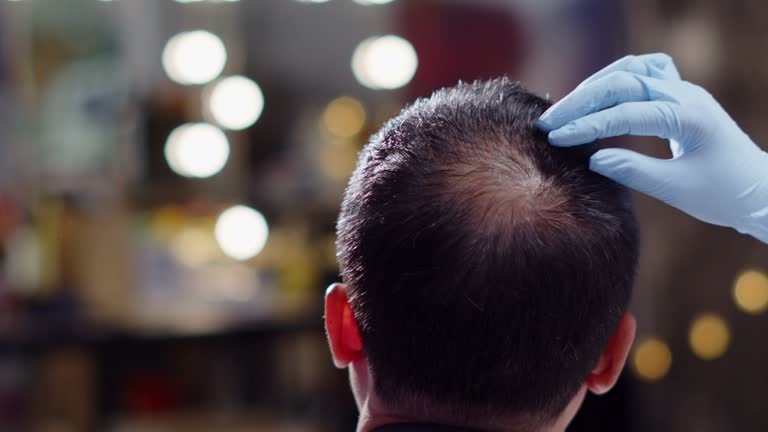 18,263 Hair Loss Stock Videos and Royalty-Free Footage - iStock | Female hair loss, Hair, Prp for hair loss 18,263 Hair Loss Stock Videos and Royalty-Free Footage - iStock | Female hair loss, Hair, Prp for hair loss