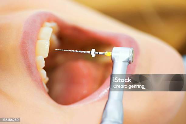 Tratamento Dentário - Fotografias de stock e mais imagens de Equipamento Dentário - Equipamento Dentário, Higiene Dental, Anestésico