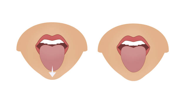 istock Exercises for the expression muscles around the lips and mouth. Relaxation and workout of muscles. Illustration 1361910909