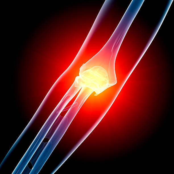 Elbow in pain x-ray stock photo