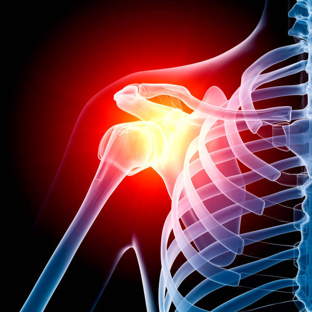 istock Shoulder in pain x-ray 136191243