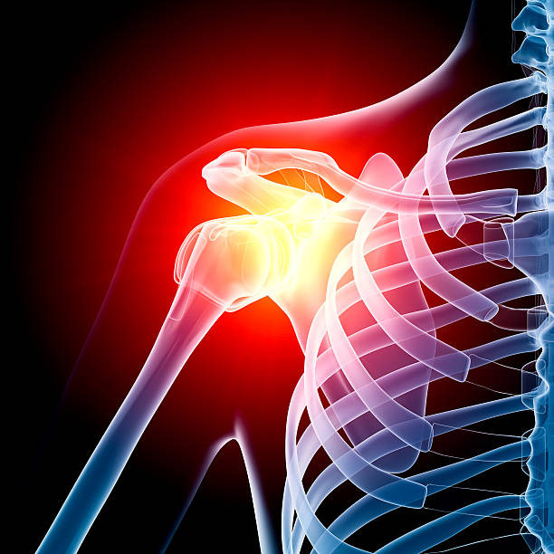 Shoulder in pain x-ray Digital medical illustration: Anterior (front) x-ray view (orthogonal) of human shoulder. With pain zone in shoulder. Featuring: 3d scanning photos stock pictures, royalty-free photos & images