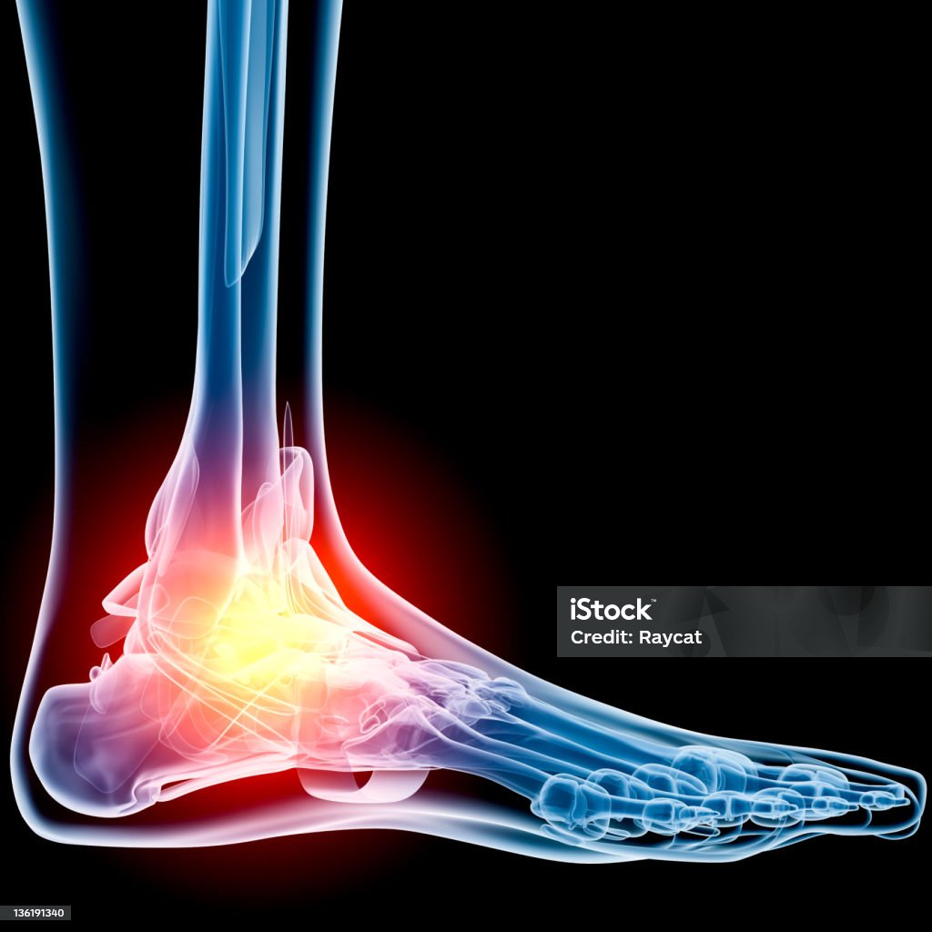 Ankle in pain x-ray Digital medical illustration: Lateral (side) x-ray view (orthogonal) of human foot and ankle. With pain zone in ankle. Featuring: Ankle Stock Photo