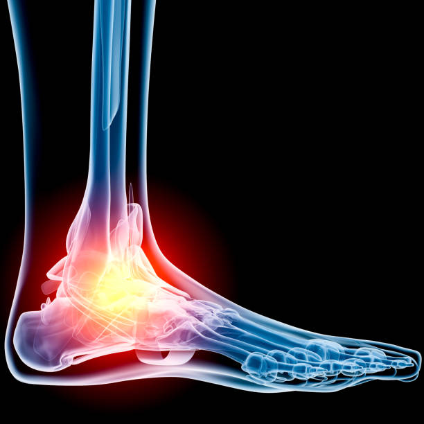 kostki w ból x-ray - human bone forensic science medical scan morphology zdjęcia i obrazy z banku zdjęć