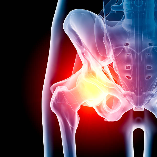 hip in pain x-ray - 人類骨架 插圖 個照片及圖片檔