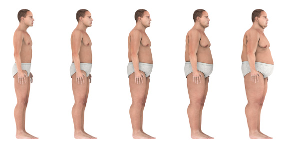 Evolution from anorexic to obese man (side views). 