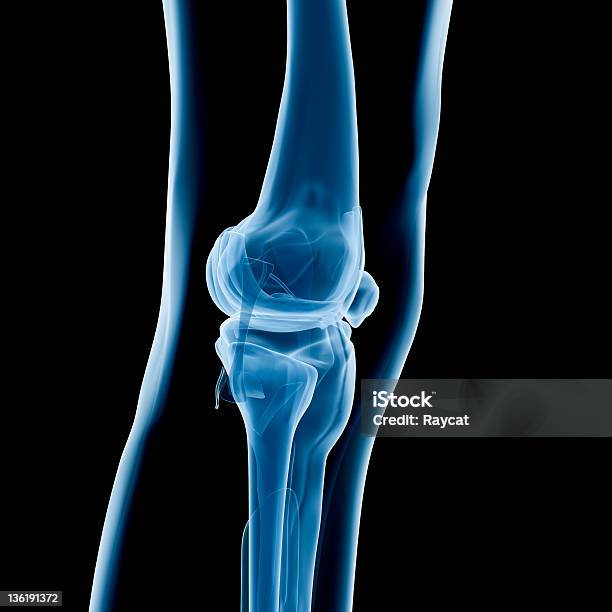 La Radiografía De La Rodilla Foto de stock y más banco de imágenes de Anatomía - Anatomía, Asistencia sanitaria y medicina, Cirugía