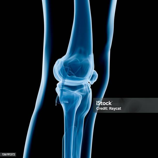 Rtg Kolana - zdjęcia stockowe i więcej obrazów Anatomia człowieka - Anatomia człowieka, Ludzie, Operacja chirurgiczna