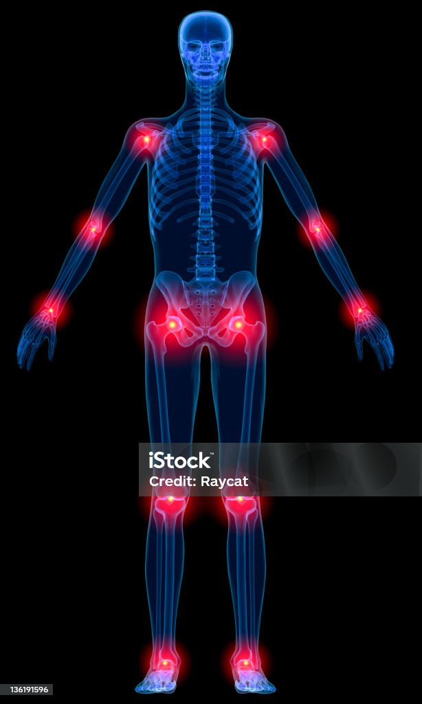 Inflammation Of Joints Stock Photo - Download Image Now - Pain, The Human Body, Full Length - iStock Inflammation Of Joints Stock Photo - Download Image Now - Pain, The Human Body, Full Length - iStock