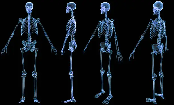 Photo of Skeleton-4 views x-ray