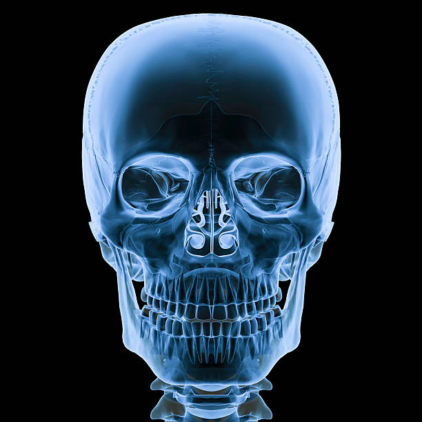 X-ray skull front view stock photo
