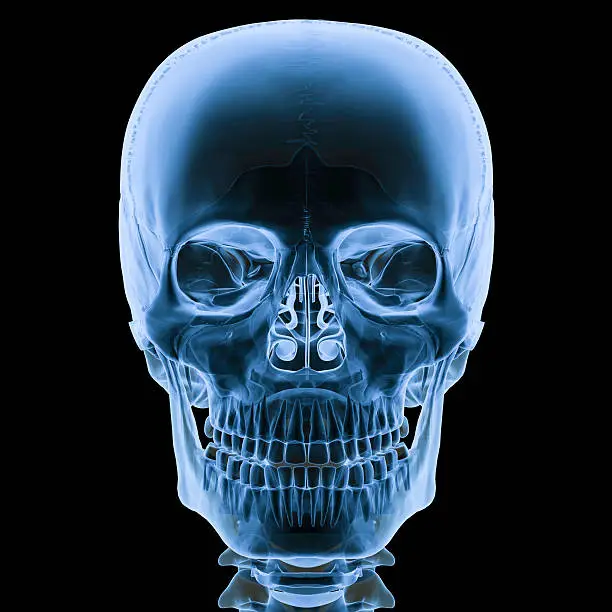 Digital medical illustration: X-ray human skull Anterior (front) view. 